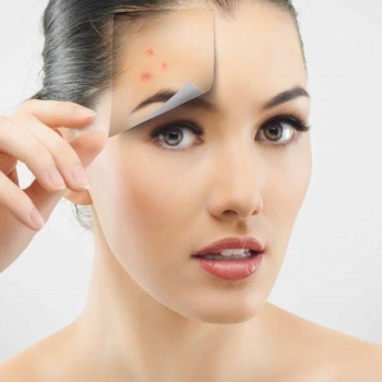 Bộ Sản Phẩm Chuyên Sâu Dành Cho Da Nhờn Mụn