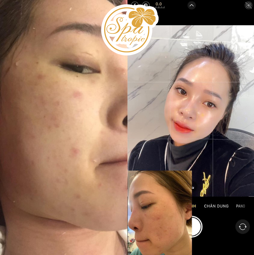 làn da trắng sáng căng bóng