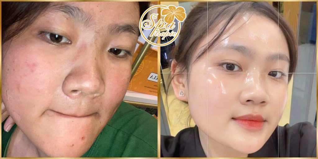 trắng sáng căng bóng tại Spa Tropic