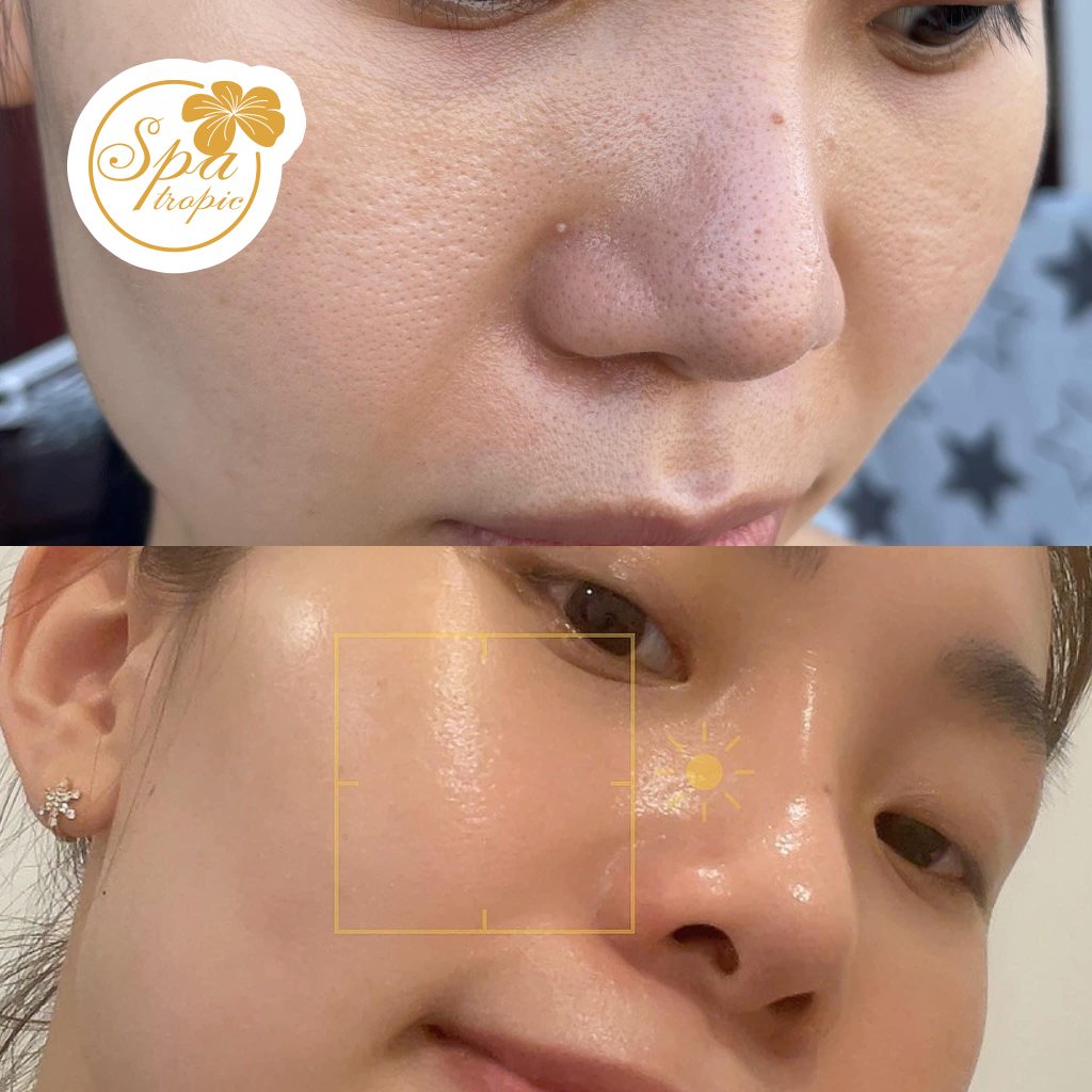 trắng sáng căng bóng tại Spa Tropic