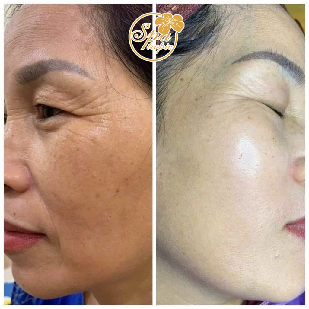 hiệu quả trắn sáng căng bóng tại Spa Tropic